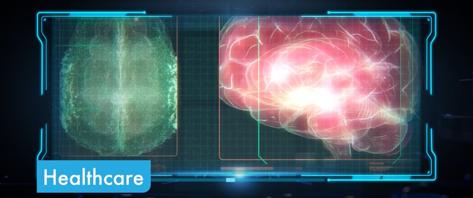 Film still: brain scans labelled Healthcare
